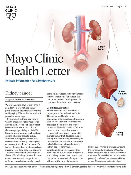 Cover image for July 2025. Mayo Clinic Health Letter